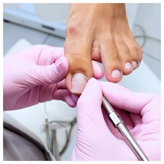 Derma Ped gallery image